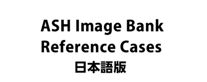 ASH Image Bank Reference Cases 日本語版